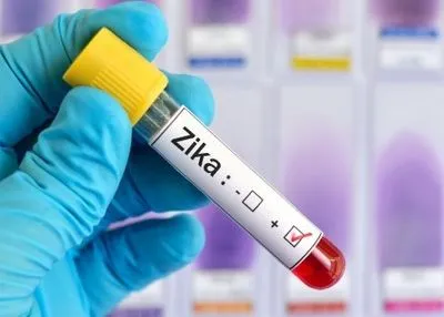 Американські вчені вивели антитіла, які нейтралізують вірус Зіка