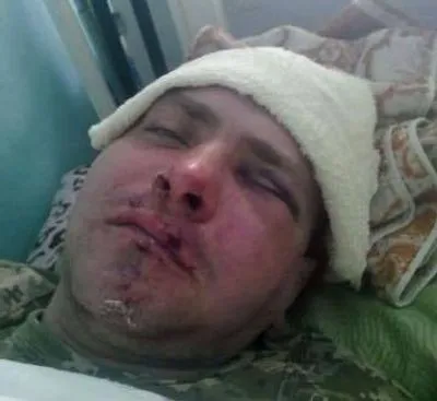 В Одесской области молодые люди избили военнослужащего АТО