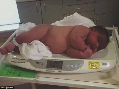 В Австралии женщина родила мальчика весом более 6 кг