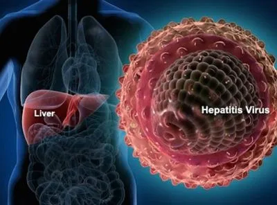 Від гепатиту С щорічно помирає близько 700 тис. людей, вакцин від хвороби немає — ВООЗ