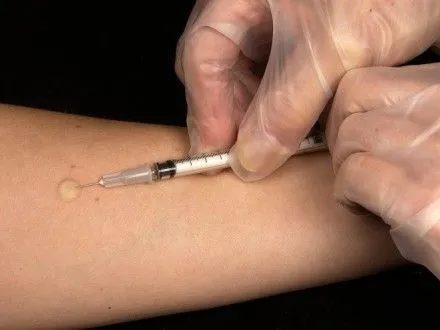 ВОЗ: в Украине самый низкий показатель вакцинации от дифтерии в регионе