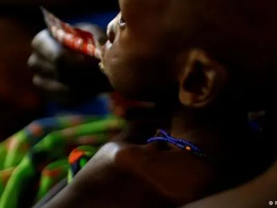 ООН: 1,4 мільйона дітей в Африці та на Близькому Сході загрожує голодна смерть