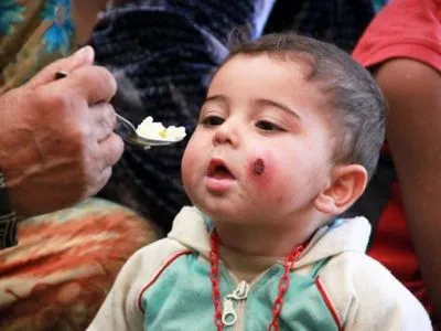В ЮНИСЕФ сообщили о рекордном числе жертв среди детей в Сирии