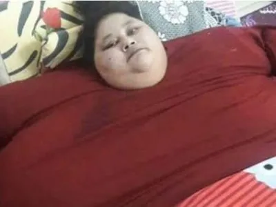 Самая толстая женщина мира похудела на 140 кг за 5 недель