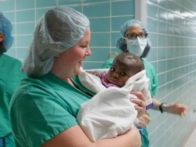 В США хирурги успешно удалили у новорожденной близнеца-паразита
