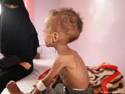 ООН: треть провинций Йемена - на грани голода
