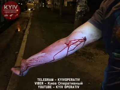У Києві чоловік "штрикнув" водія тролейбуса ножем