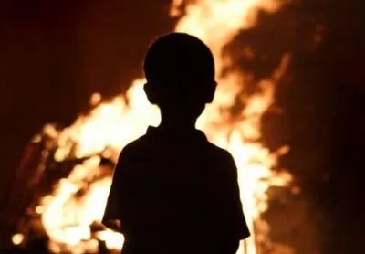 Двухлетний мальчик сильно обгорел в Ровенской обл.