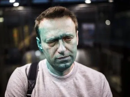 У РФ порушили кримінальну справу за фактом нападу на О.Навального