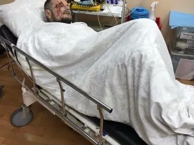 З'явились фото нардепа Мосійчука з лікарні