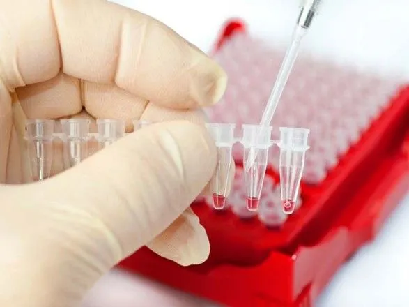 За тиждень у Запоріжжі зафіксовано три випадки захворювання на вірусний гепатит