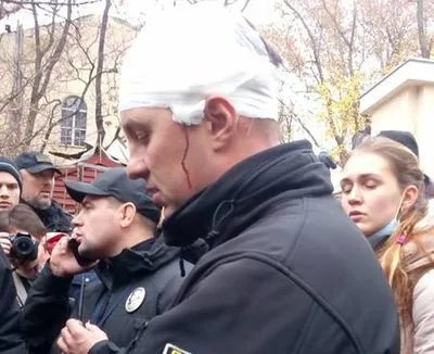 В результате столкновений возле Летнего театра пострадал начальник полиции Одесской области