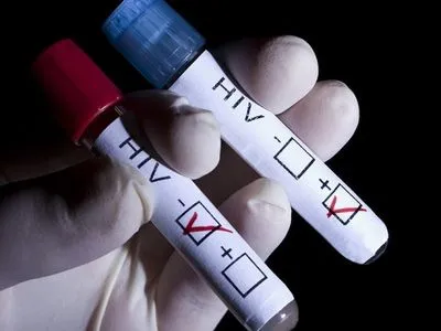 В Украине ежегодно регистрируется 15 тысяч больных с ВИЧ