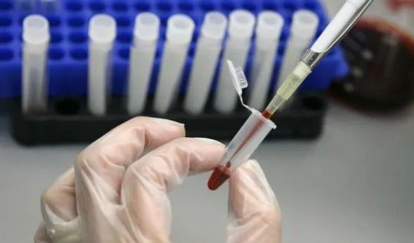 Гепатит А в Николаеве: количество больных детей достигло 12 человек