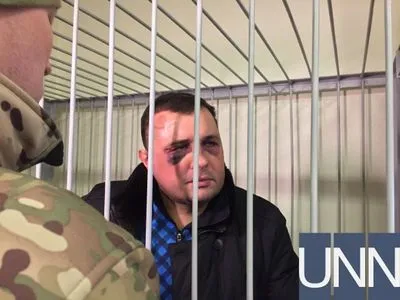 В СБУ еще не установили, кто избил экс-нардепа Шепелева
