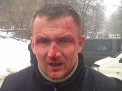Избиение нардепа Левченко будут расследовать как "насилие в отношении государственного деятеля" - прокуратура