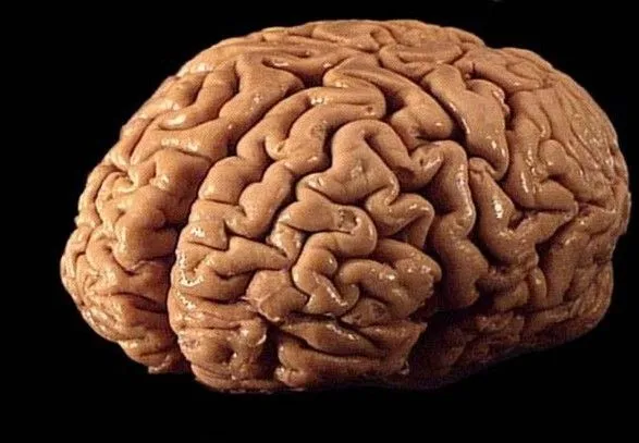 Вчені навчилися зберігати мозок живим поза тілом