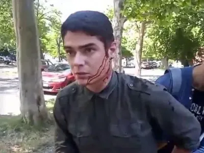 С активиста "Автомайдана", на которого напали в Одессе, сняли госохрану