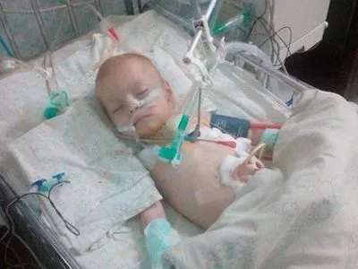 Лікарі два місяці рятують малюка, який проковтнув батарейку в Кропивницькому