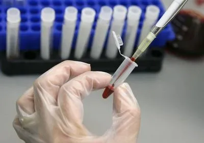 В Британии начали расследовать заражение тысяч пациентов гепатитом и ВИЧ