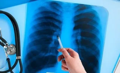 Школярка захворіла на туберкульоз у Мелітополі
