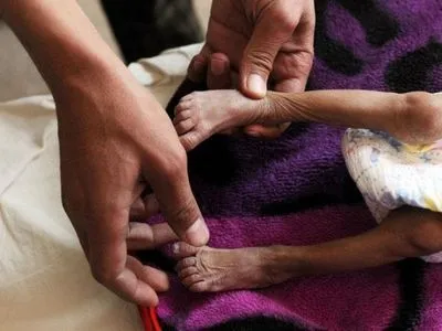 ВООЗ: 80% населення Ємену потребує допомоги