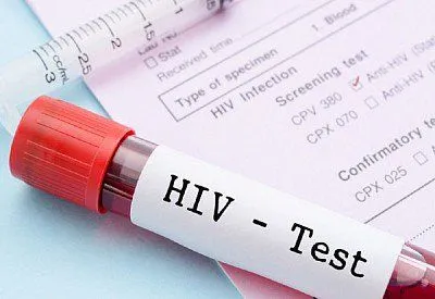 В прошлом месяце в Украине зарегистрировано более 1,5 тысячи ВИЧ-инфицированных