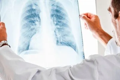 На лекарства против туберкулеза в прошлом году из бюджета выделили почти 500 млн грн