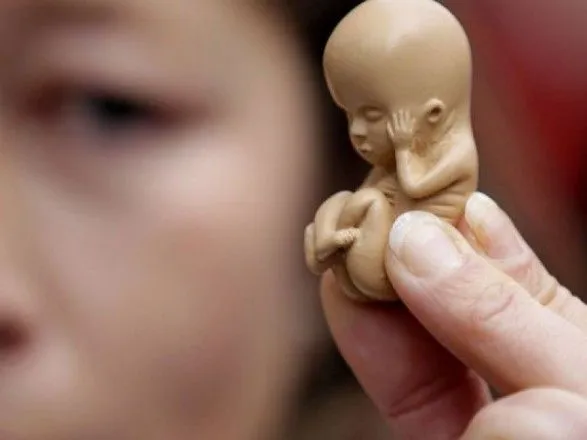 В Україні майже 400 неповнолітніх осіб минулого року зробили аборти