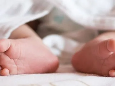 Лікарі зібрали консиліум: стали відомі подробиці про стан новонароджених сіамських близнюків