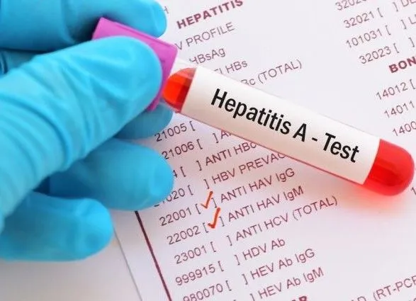 Гепатит в черниговской школе: количество учеников в больнице увеличилось до 15