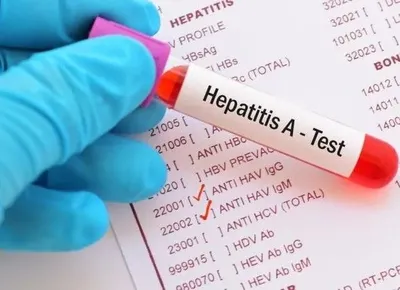 Гепатит у Чернігові: захворіли вже троє дорослих і 23 дитини