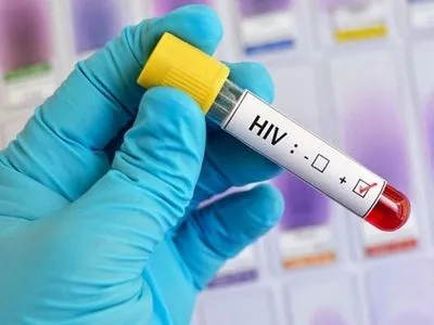 Американські дослідники виявили новий штам ВІЛ – WSJ