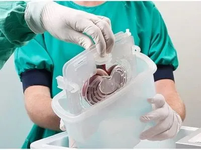 В Україні вперше проведено трансплантацію нирки у районній лікарні