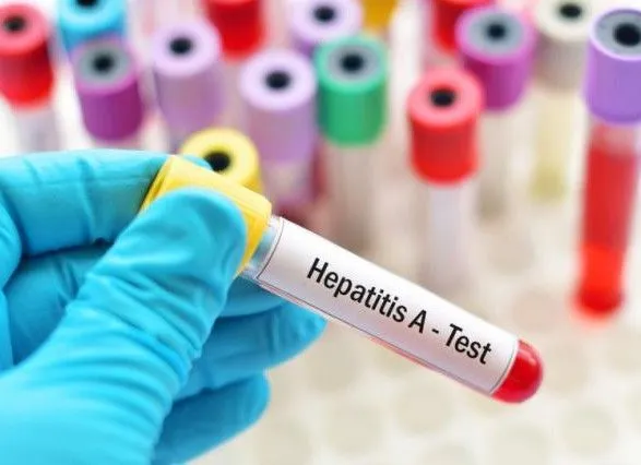 Спалах вірусного гепатиту в Чернігові: кількість хворих зросла до 41