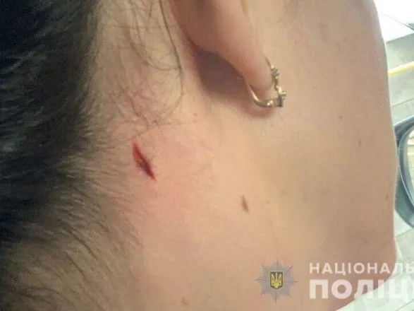 В Николаеве во время стрельб полицейских пострадала женщина