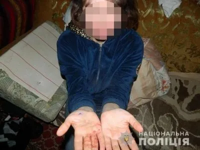 У Києві жінка порізала брата, захищаючи матір