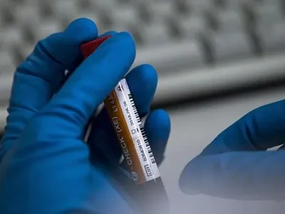 В Беларуси опровергли заражения коронавируса в госпитализированного девушки