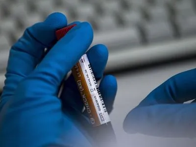 Україна отримає 30 комплектів тест-систем на виявлення нового коронавірусу