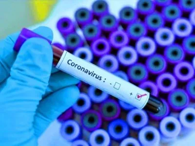 В Минздраве рассказали, сколько стоит тест-система для проверки на коронавирус