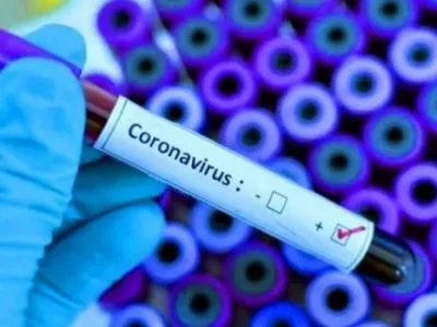 Діагностика, терміни, результати: що треба знати про тест-системи для виявлення коронавірусу
