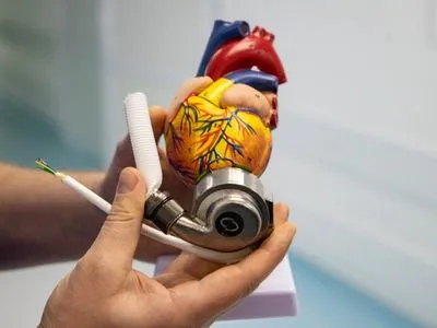 У лікарні Києва вперше імплантували механічне серце
