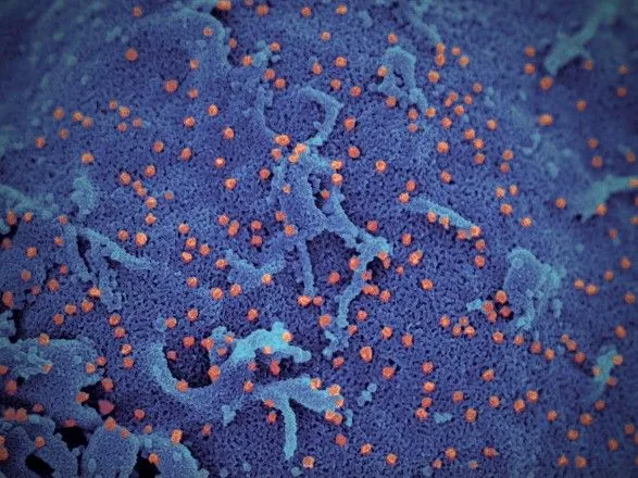 Ученые показали новые изображения коронавируса под микроскопом