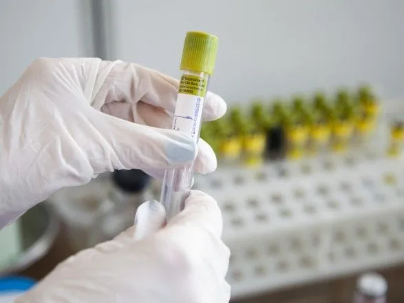В Италии зафиксировано 229 инфицированных коронавирусом, украинцев среди них нет - посол