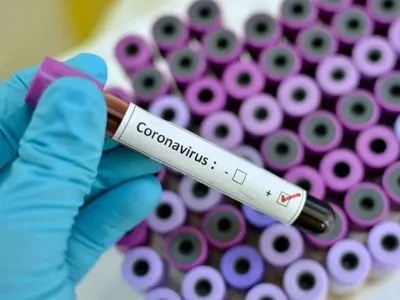 Кількість заражених на новий коронавірус у Південній Кореї зросла до понад 830 осіб