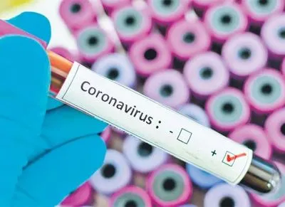 Есть ли вероятность, что коронавирус уже в Украине: в Минздраве не смогли ответить