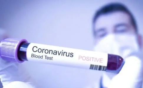 Українка в Італії захворіла на коронавірус
