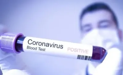 Мойте руки, носите защитную маску и берегите себя: рекомендации, как уберечь себя от коронавируса