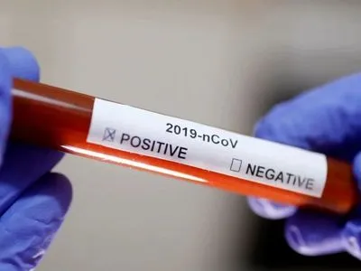 У Франції на новий коронавірус захворіло 377 людей, шестеро померло
