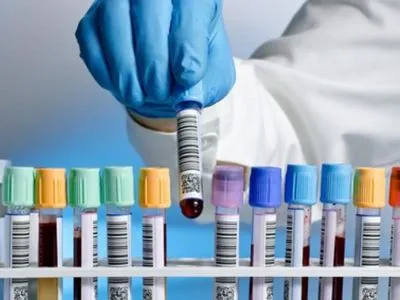 Лондонская лаборатория подтвердила коронавирус у инфицированного в Украине